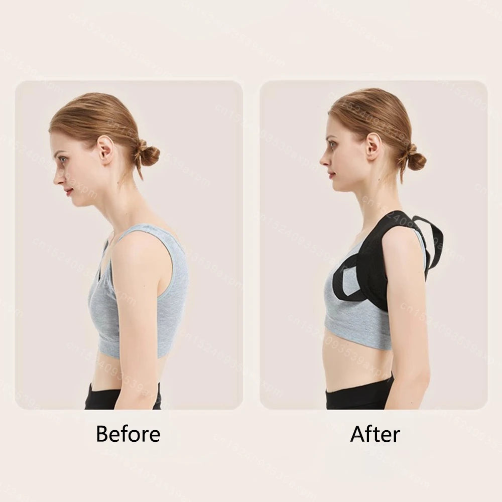 Back Posture Corrector Clavicle Spine Back Belt Adjustable Unisex